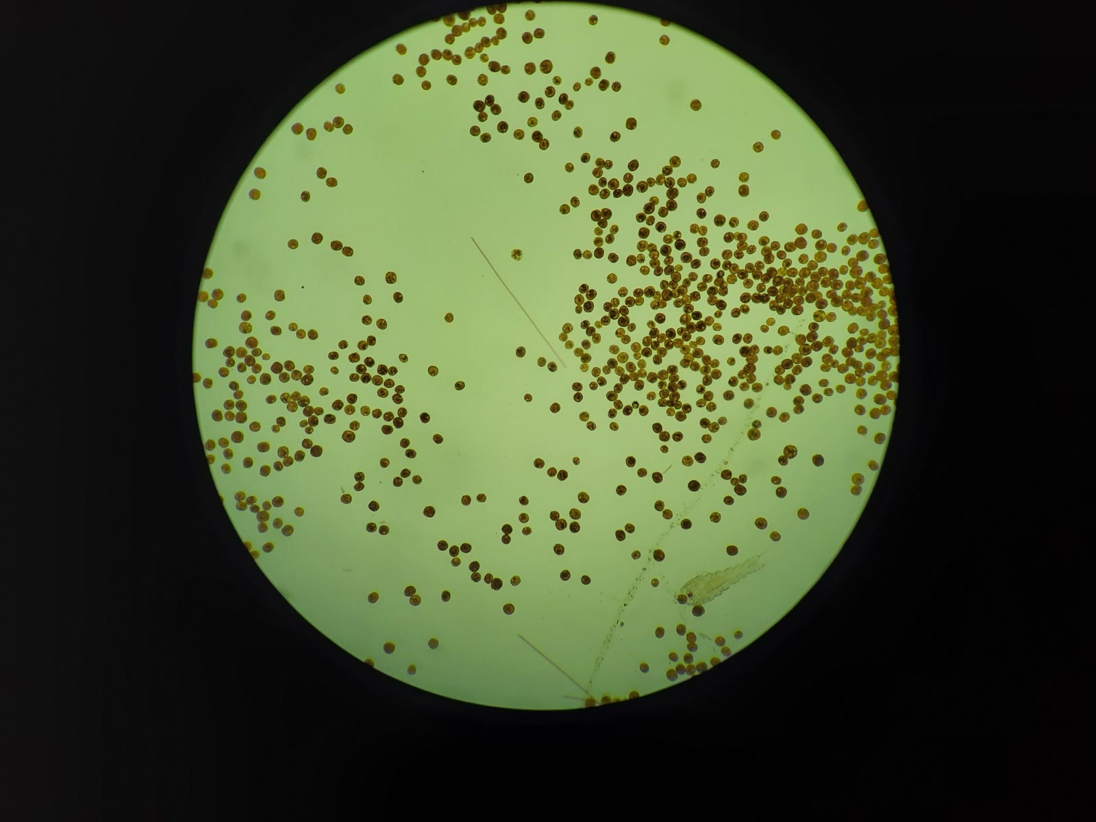 Round brown dino cells in a microscope field