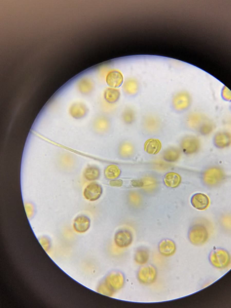 Small round golden dinoflagellate cells