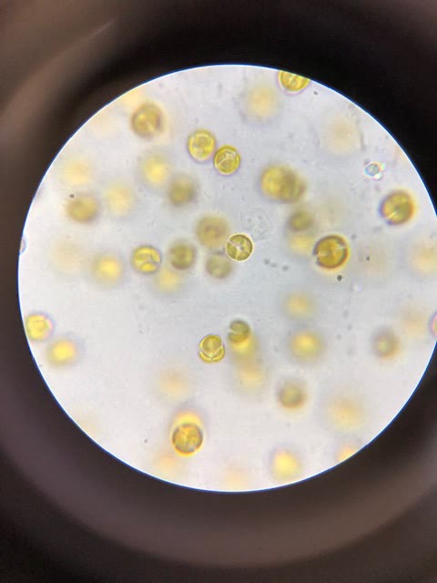 Small round golden dinoflagellate cells