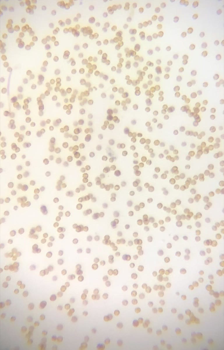 Small round golden dinoflagellate cells